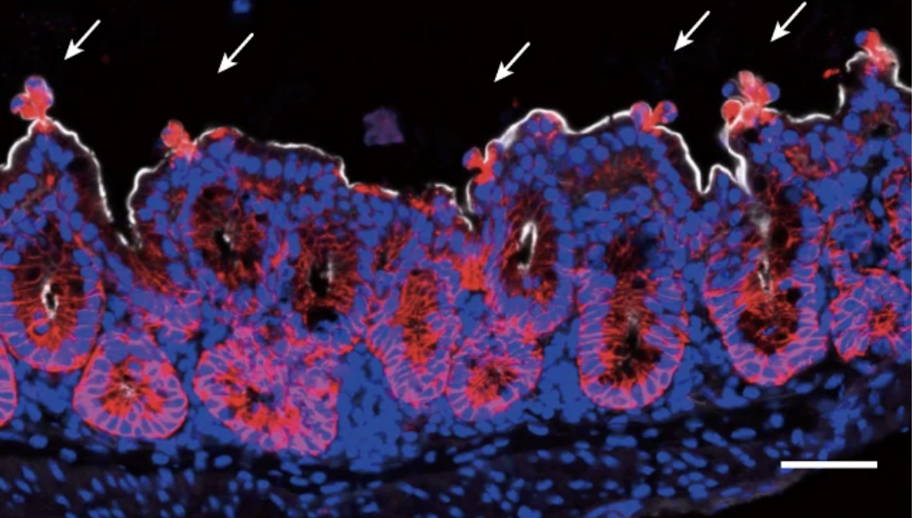 Fluorescence microscopy of IEC extrusion