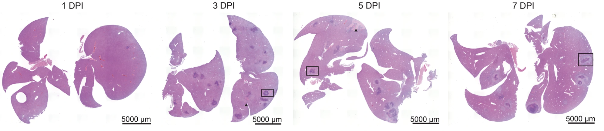 Granuloma time-course microscopy data
