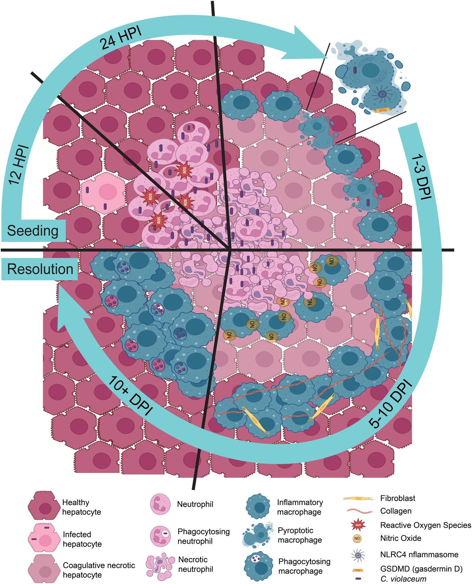 Illustration of innate granuloma response around Chromobacterium violaceum infection